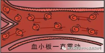 血小板是正常值的三倍？專(zhuān)家提醒小心血栓和出血！