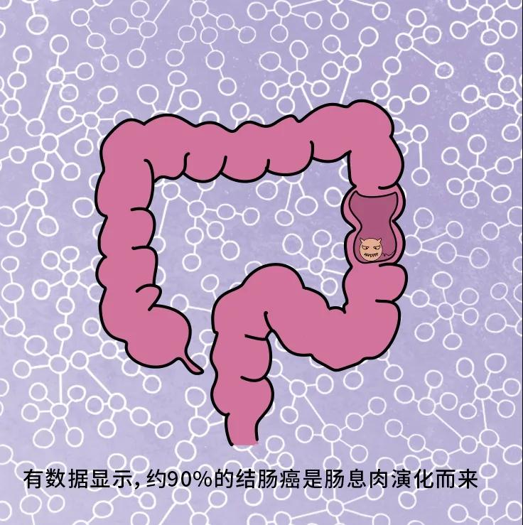奪走“黑豹”生命的結(jié)腸癌，到底什么來頭？