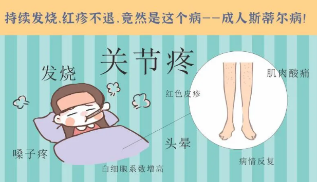持續(xù)發(fā)燒、紅疹不退……她終于在這里治好了這個罕見病
