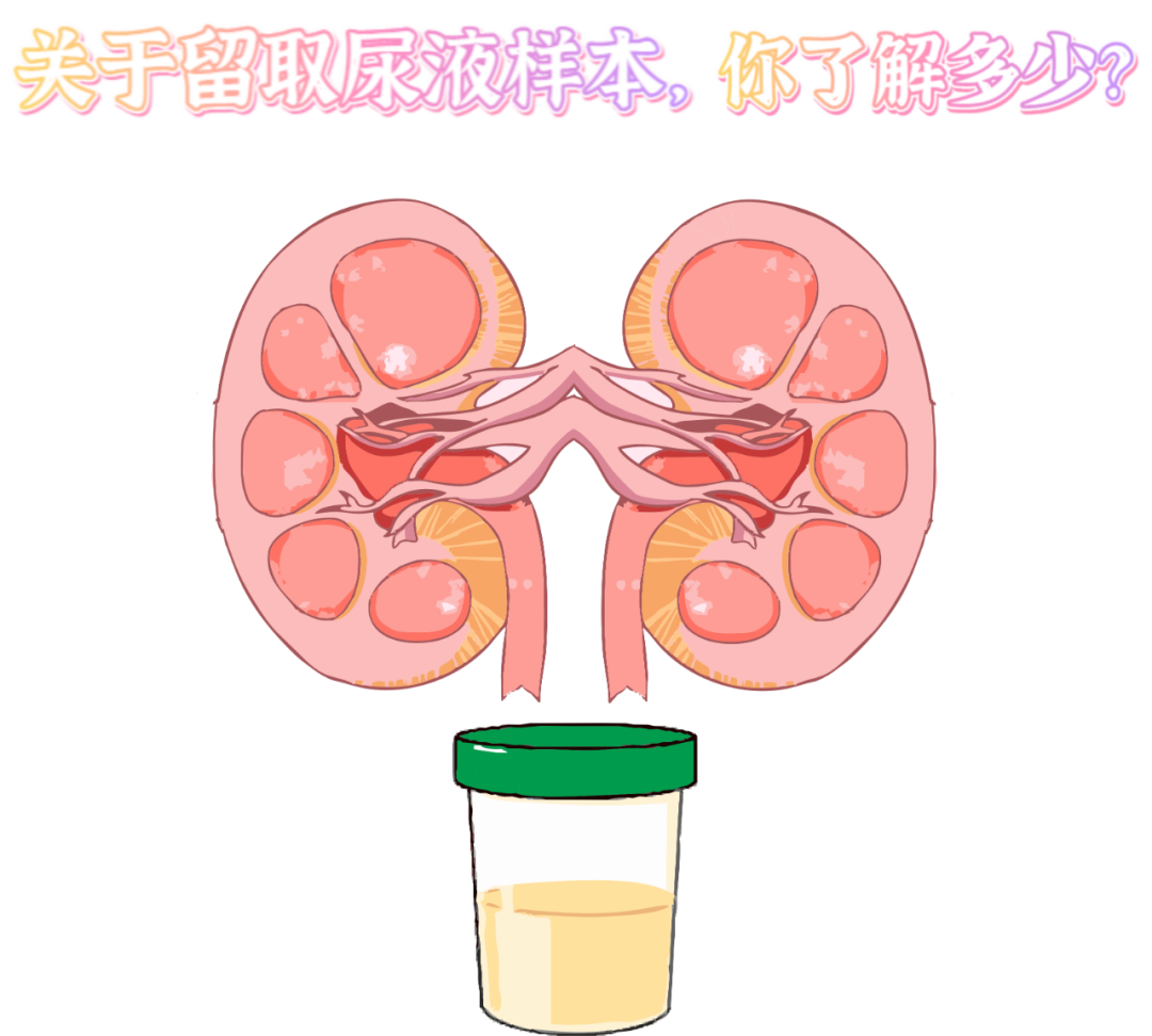 做尿檢，不得不說的注意事項！