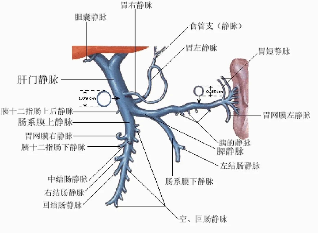 反復(fù)嘔血、黑便怎么辦？TIPS手術(shù)能解決