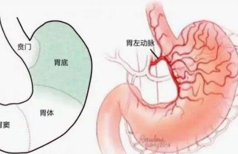 不開(kāi)刀不吃藥不餓肚子，微創(chuàng)介入減肥靠譜嗎？