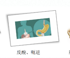 關(guān)愛身體健康，輕松檢查胃腸