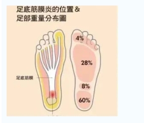 每年新生數(shù)百萬足底筋膜炎患者！國際醫(yī)學(xué)專家提醒：跑步要選擇合適的鞋